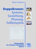 ISBN 9783876527130: Doppelkronen: Systeme, Gestaltung, Planung, Fallbeispiele – Kompendium der dentalen Frästechnik, Band 2