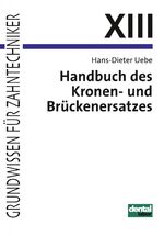 ISBN 9783929360097: Handbuch des Kronen- und Brückenersatzes