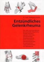 ISBN 9783980660785: Entzündliches Gelenkrheuma