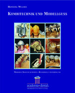 ISBN 9783980911108: Kombitechnik und Modellguss: Ein Leitfaden: Moderne Konstruktion, Rationelle Anfertigung [Gebundene Ausgabe] Wulfes, Henning