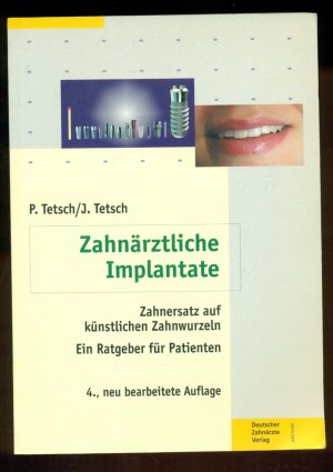 Zahnärztliche Implantate / Zahnersatz auf künstlichen Zahnwurzeln--Ein Ratgeber für Patienten