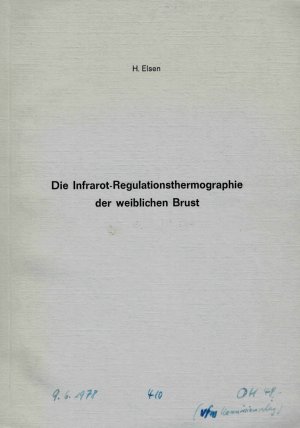 Die Infrarot-Regulationsthermographie der weiblichen Brust.