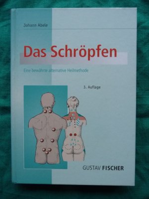 Das Schröpfen