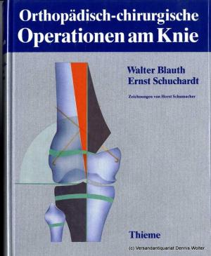 Walter Blauth, Ernst Schuchardt (Autoren) - Orthopdisch-chirurgische Operationen am Knie