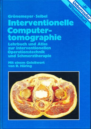 Interventionelle Computertomographie