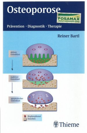 gebrauchtes Buch – Reiner Bartl – Osteoporose