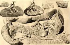 antiquarisches Buch – Bidloo, Govert/ Cowper – Anat. corp. human., 36.Tab.: Lower Part of the Stomach and a Portion of the Intestinum Duodenum continued to it, together with the Pancreas and Spleen. antiquarisches Buch – Bidloo, Govert/ Cowper – Anat. corp. human., 36.Tab.: Lower Part of the Stomach and a Portion of the Intestinum Duodenum continued to it, together with the Pancreas and Spleen.