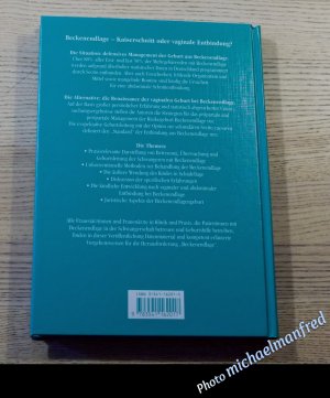 gebrauchtes Buch – Feige, Axel; Krause – Beckenendlage