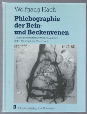 Phlebographie der Bein- und Beckenvenen.