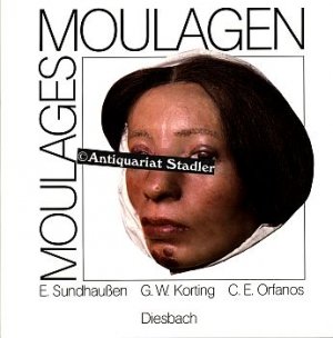 Moulagen. Moulages. In deutscher u. engl. Sprache.