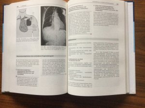 gebrauchtes Buch – Wietholt, Dietmar; Ulbricht – Implantierbare Kardioverter-Defibrillatoren (ICD):