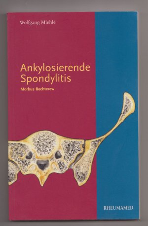 Ankylosierende Spondylitis - Morbus Bechterew