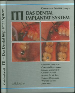 ITI, das Dental-Implantat-System: Anwendungen in Praxis, Klinik und Dentallabor