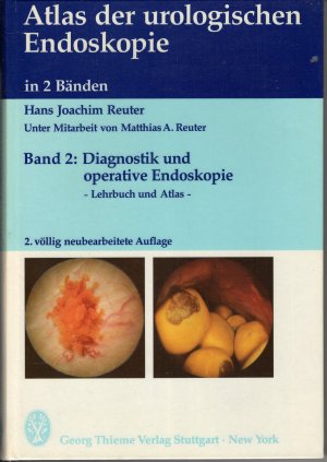 Atlas der urologischen Endoskopie Band 2 / Diagnostik und operative Endoskopie