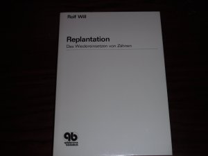 Replantation - Das Wiedereinsätzen von Zähnen