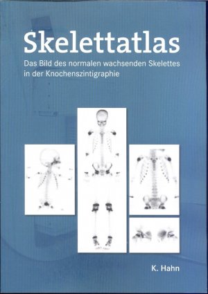 gebrauchtes Buch – Klaus Hahn – Skelettatlas. Das Bild des normalen wachsenden Slekettes in der Knochenszintigraphie