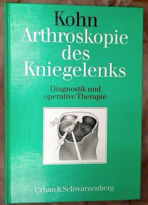 gebrauchtes Buch – Dieter Kohn – Arthroskopie des Kniegelenks