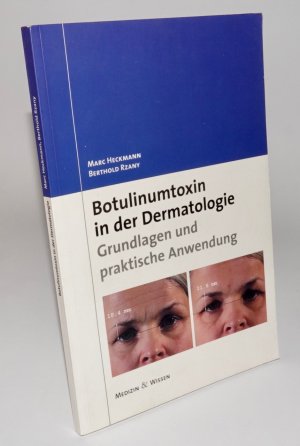 gebrauchtes Buch – Heckmann, Marc; Rzany – Botulinumtoxin in Der Dermatologie: Grundlagen Und Praktische Anwendung (Deutsch) Taschenbuch