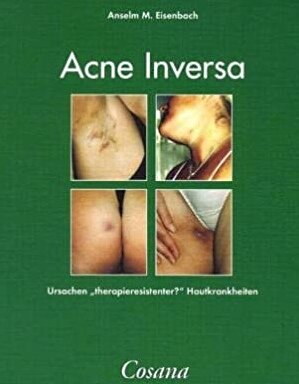 gebrauchtes Buch – Eisenbach, Anselm M – Akne inversa - Ursachen "therapieresistenter" Hautkrankheiten