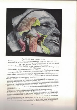 Atlas pathologischer und klinischer Anatomie für Dentisten - 1937 (Fotografien)