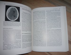 gebrauchtes Buch – Klaus Poeck – Neurologie