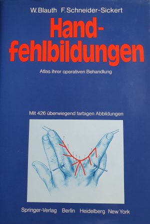 Handfehlbildungen