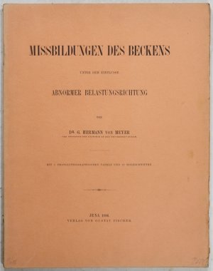 Missilbungen des Beckens unter dem Einfluss abnormer Belastungsrichtung.