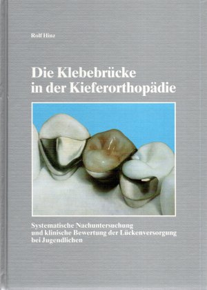 Die Klebebrücke in der Kieferorthopädie