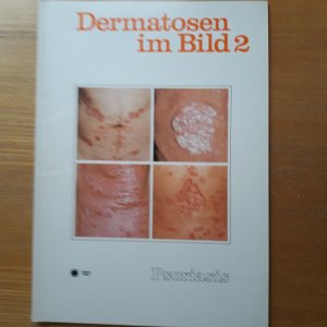 gebrauchtes Buch – Schröpl F. – Dermatosen im Bild 2 Psoriasis