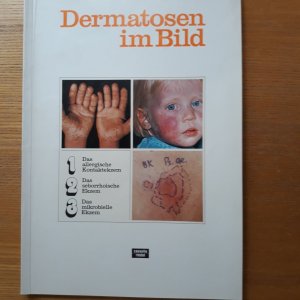 gebrauchtes Buch – Rudolf Schuppli – Dermatosen im Bild Das allergische Kontaktekzem