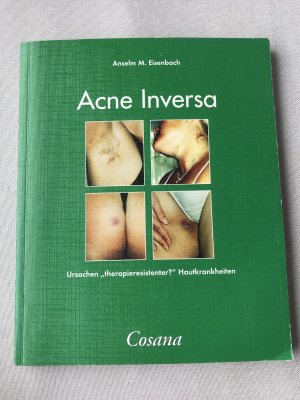 Akne inversa - Ursachen "therapieresistenter" Hautkrankheiten