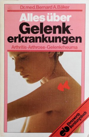 gebrauchtes Buch – Bäker, Bernard A. – Alles über Gelenkerkrankungen: Arthrutis  - Arthrose - Gelenkrheuma