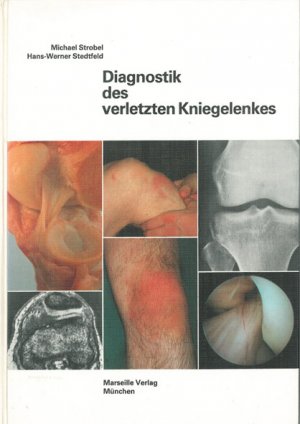 gebrauchtes Buch – Strobel, Michael; Stedtfeld – Diagnostik des verletzten Kniegelenkes