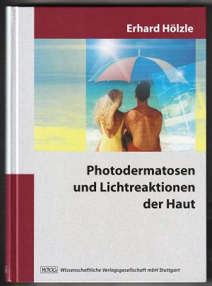 Photodermatosen und Lichtreaktionen der Haut