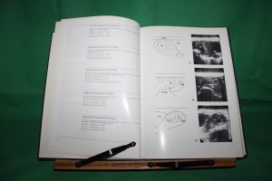 Ultrasonoscopic Differential Diagnosis in Obstetrics and Gynecology / Echoskopische Differential-Diagnose in Geburtshilfe und