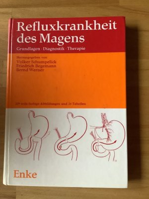 Refluxkrankheit des Magens, Grundlagen, Diagnostik, Therapie