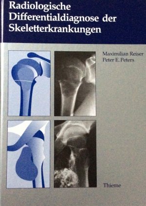 Radiologische Differentialdiagnose der Skeletterkrankungen