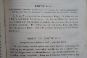 antiquarisches Buch – Pabst, Louis. Notizen über Gelenkkrankheiten unter Mitanwendung des Bades zu Oeynhausen – Pabst, Louis. Notizen über Gelenkkrankheiten unter Mitanwendung des Bades zu Oeynhausen. Erste Ausgabe. Leipzig, in Commission bei Wilhelm Naundorf, 1856. IV, 68 S. Broschur.