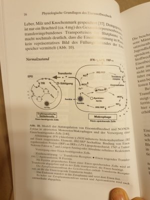 gebrauchtes Buch – Wick, M.; Pinggera – Eisenstoffwechsel, Anämien Therapie und Diagnose - Neue Konzepte bei Renaler Anämie und Rheumatoider Arthritis