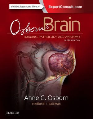 Osborn’s Brain - Imaging, Pathology, and Anatomy