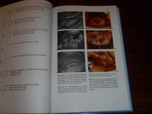 gebrauchtes Buch – Henning Bartels – Raumforderungen der Niere im sonographischen Bild: Textbuch und Atlas - Mit 283.Abb. in 509 Einzeldarstellungen