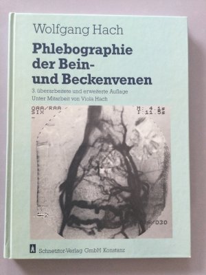 Phlebographie der Bein- und Beckenvenen