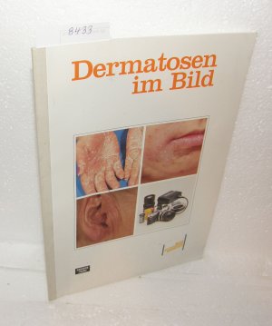 Dermatosen im Bild