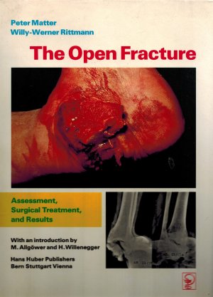 The Open Fracture.