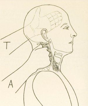 Die "Technik der Massage des Bewegungsapparates, der männlichen und weiblich Beckenhöhle" 2. Band von "Lehrbuch der Massage"