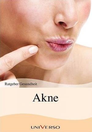 gebrauchtes Buch – Akne gebrauchtes Buch – Akne