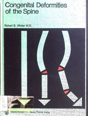 Congenital deformities of the spine.