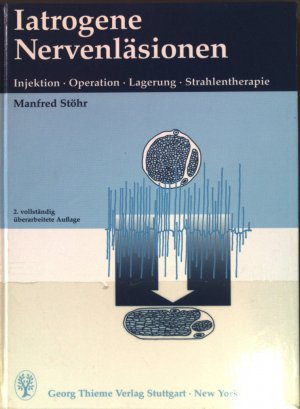 Iatrogene Nervenläsionen : Injektion, Operation, Lagerung, Strahlentherapie.