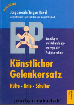 Künstlicher Gelenkersatz Hüfte- Knie - Schulter