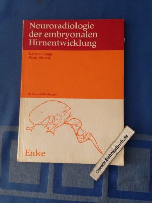 Neuroradiologie der embryonalen Hirnentwicklung.